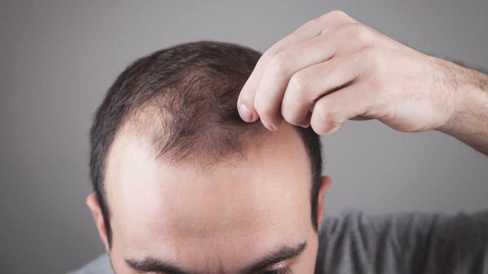 Drug Abuse and Hair Loss: What You Need to Know